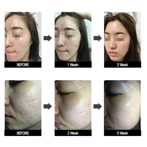 CF Magic LED Mask (360 LED) - Health Korea Shop